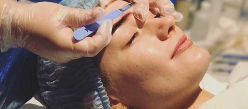 Dermaplaning Facial